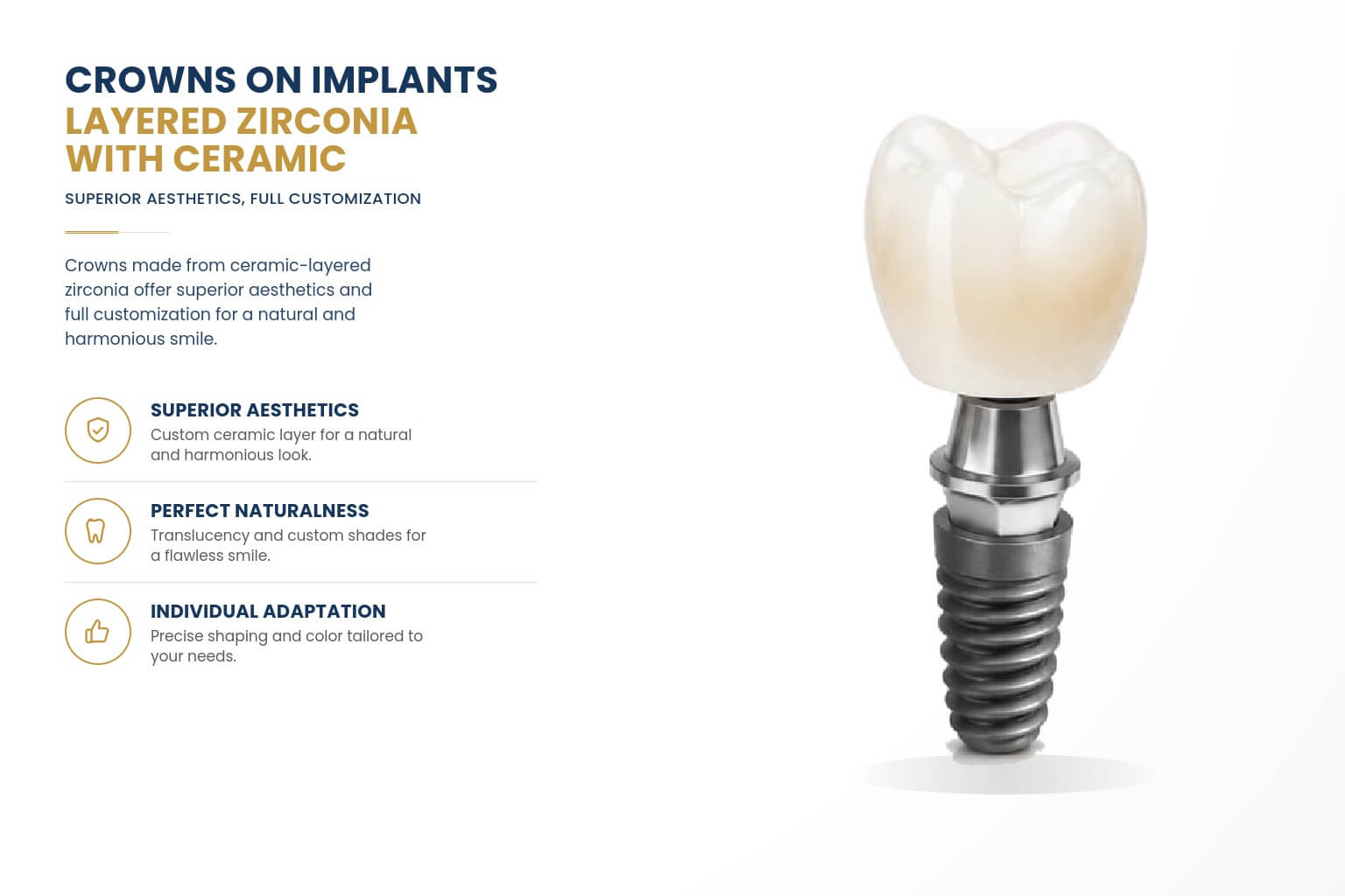 Crowns on implants layered zirconia with ceramic