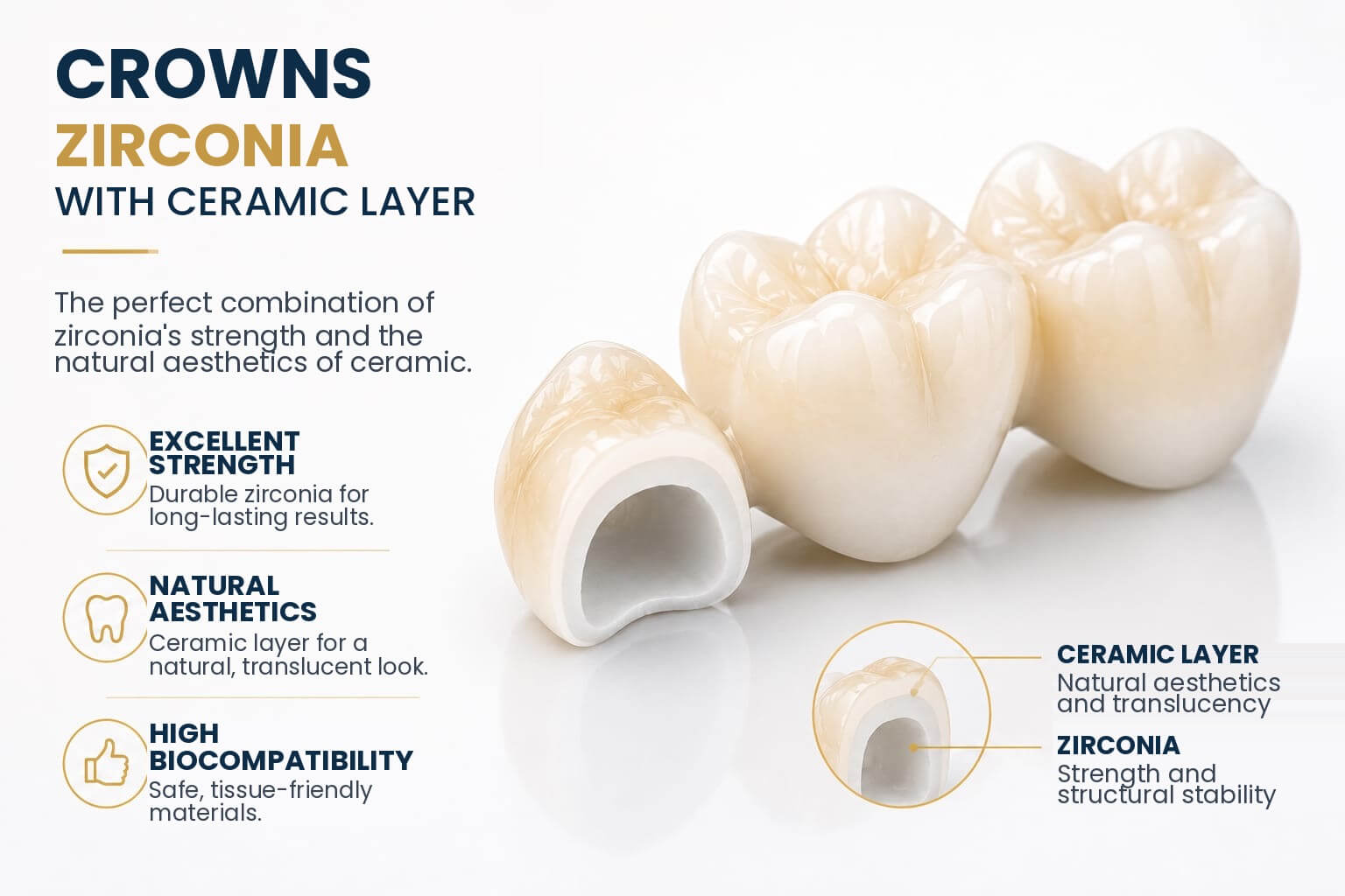 Layered Zirconia Crowns