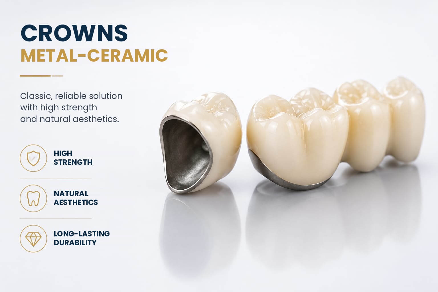 Metal-Ceramic Crowns